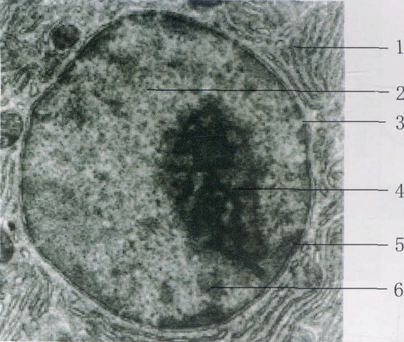 图1-3 细胞核电镜结构